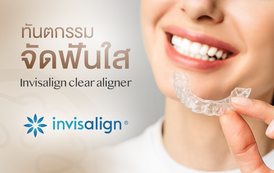 จัดฟันใส Invisalign clear aligner - DentSocietyclinic